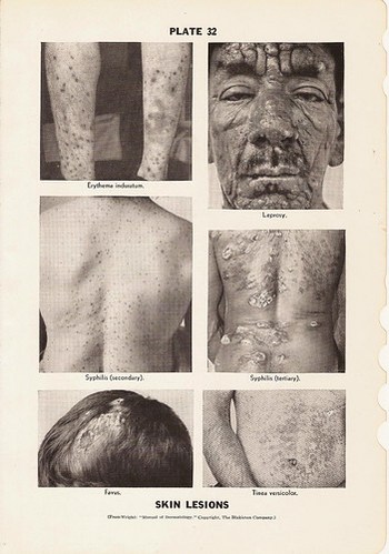 Skin LESIONS and Various Types of Bandages Black and White Medical Dictionary Reference Book Plate Print No. 32 and 33